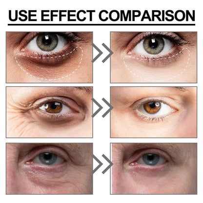 Niacinamide Eye Cream Reduces Dark Circles and Eye Bags Sodium Hyaluronate Moisturizing Essence Reduces Puffiness Eye Care