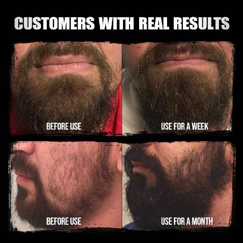 Beard Oil Mild Nourishing Beard Essential Oil 30ml