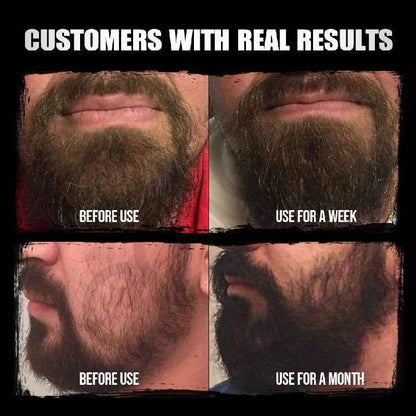 Beard Oil Mild Nourishing Beard Essential Oil 30ml